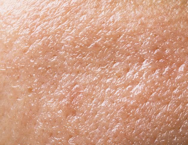 OILY SKIN TYPE