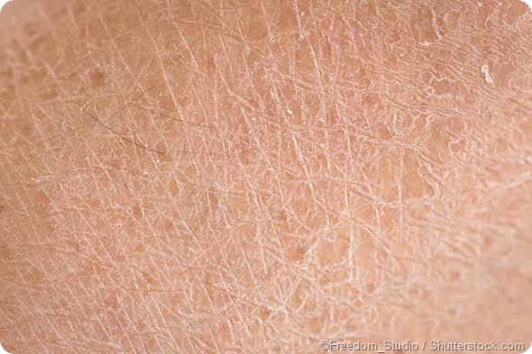 DRY SKIN TYPE